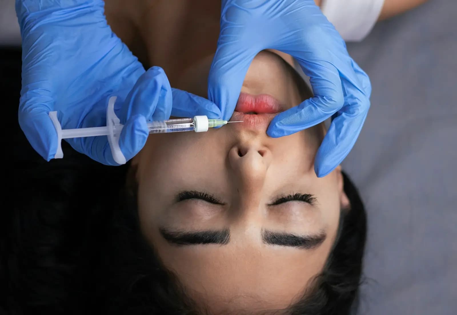 Doctor giving a lip filler injection